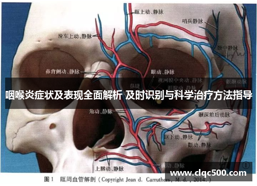 咽喉炎症状及表现全面解析 及时识别与科学治疗方法指导